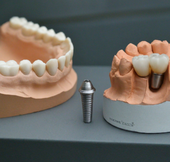 As impressoras 3D estão revolucionando a odontologia. Conheça suas aplicações e os benefícios para dentistas e pacientes.